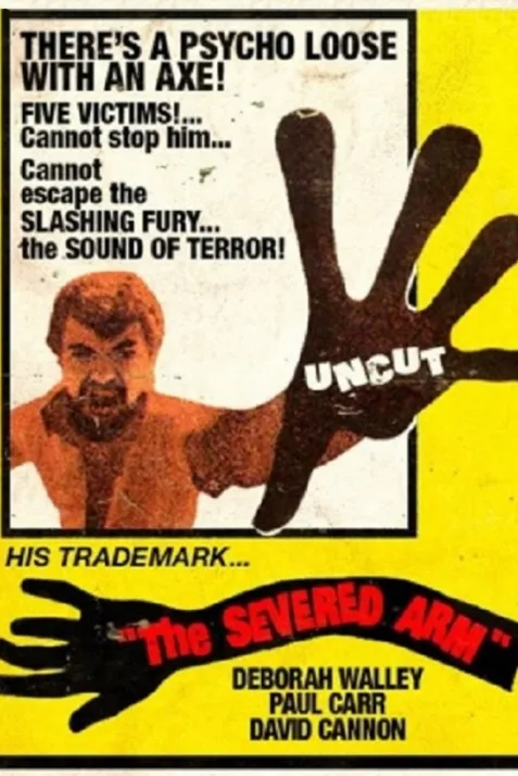 The Severed Arm