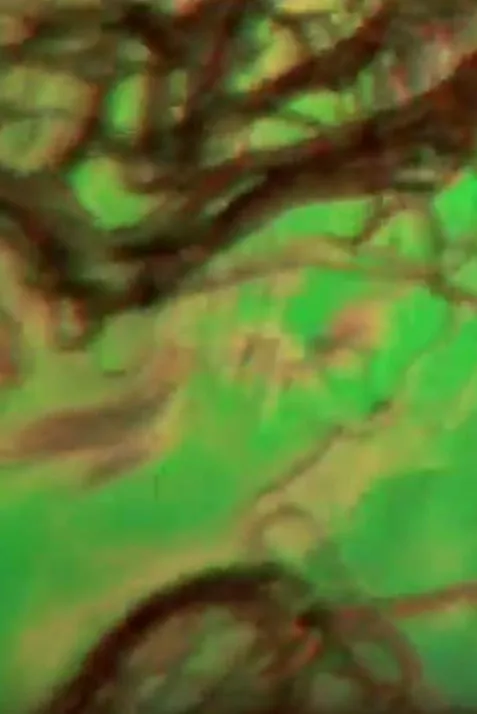 Liquid Crystals