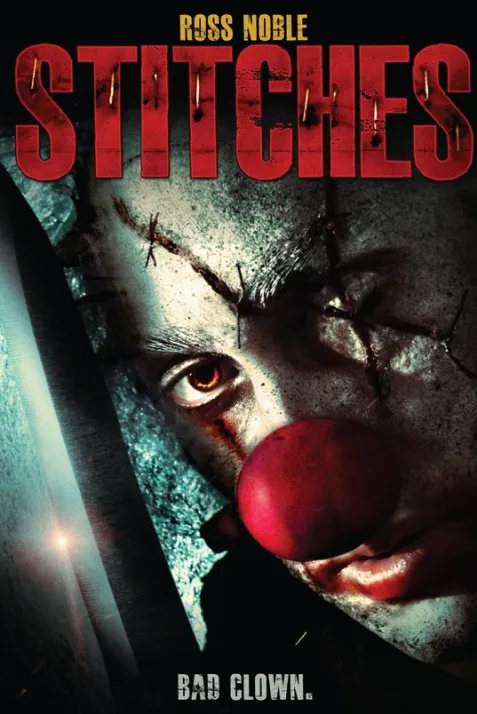 Stitches