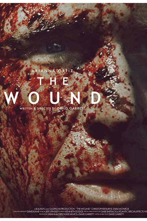 The Wound