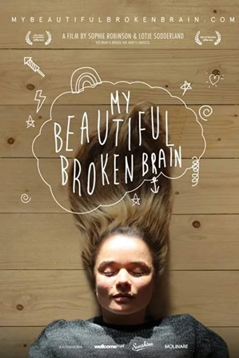 My Beautiful Broken Brain