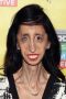 Lizzie Velasquez
